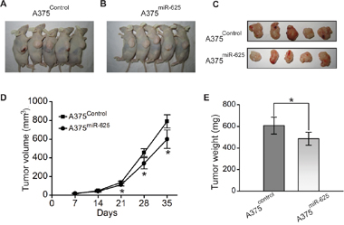 miR-625 inhibits tumorigenicity of malignant melanoma cells in vivo.