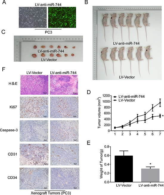 Reduction of MiR-744 suppresses the formation of prostate xenograft tumors in vivo.