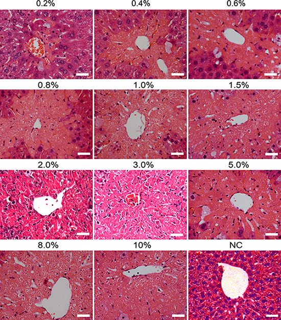 Histological changes in liver tissues of mice induced by different doses of carbon tetrachloride.