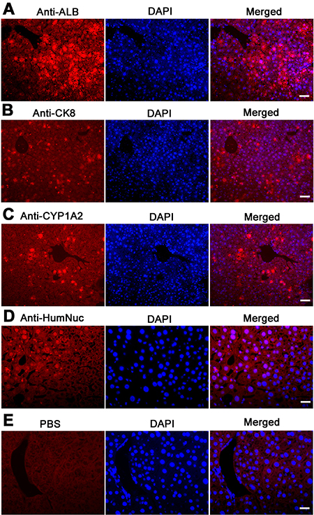 The expression of ALB, CK8, and CYP1A2 in graft hepatic tissues of recipient mice.
