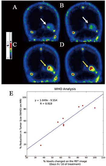 Assessment of response of brain metastases to radiotherapy by PET imaging of apoptosis with