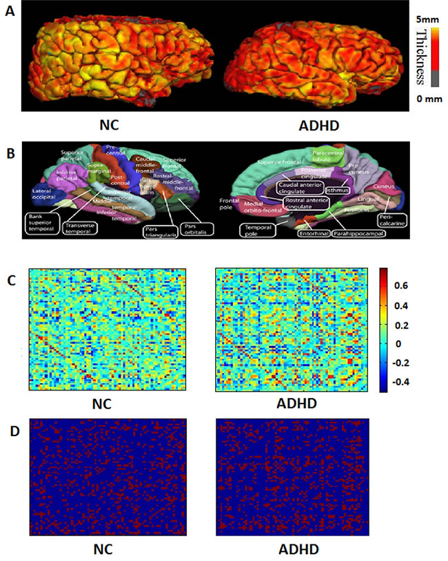 The flowchart illustrates the construction of structural cortical networks.