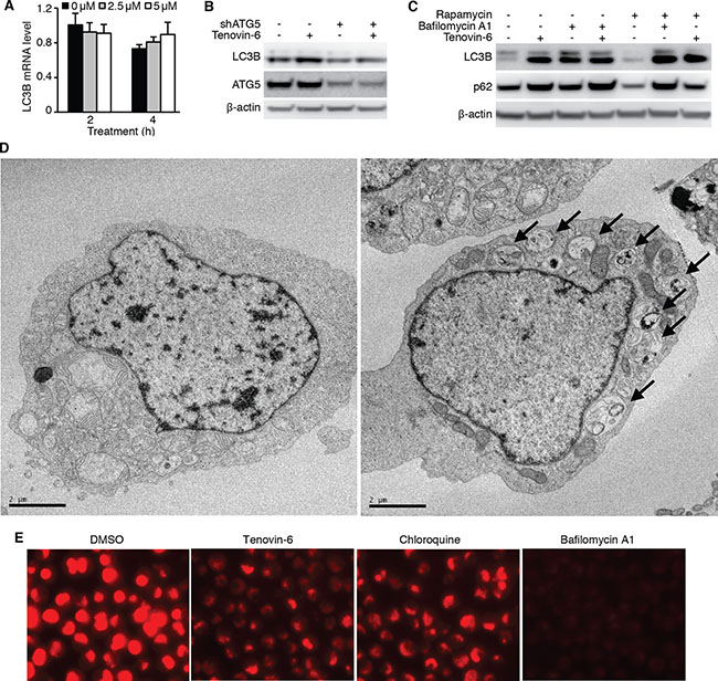 Tenovin-6 increases LC3B-II level by inhibiting the classical autophagy pathway.