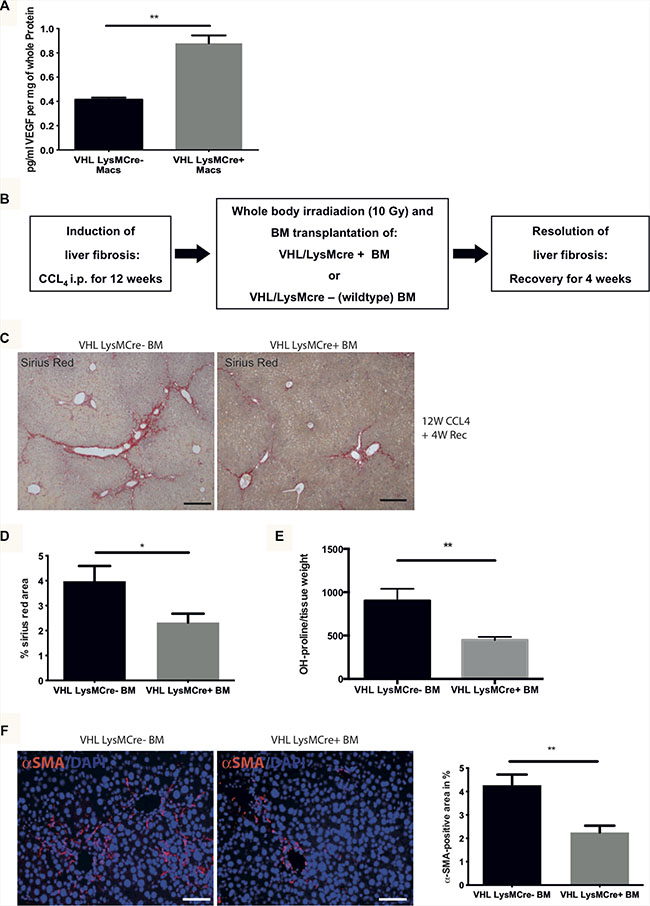 Transplantation of bone marrow from VHLfl/fl-LysMCre+ mice into C57Bl6/J mice after CCl4-challenge accelerates fibrosis resolution as compared to mice after reconstitution with wildtype (VHLfl/fl-LysMCre-) bone marrow.