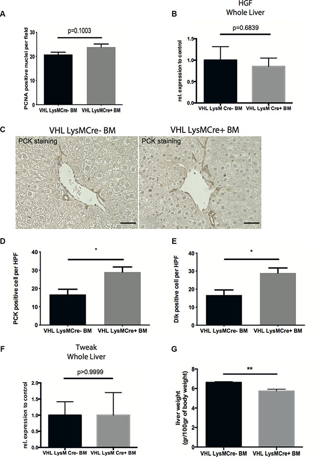 Deletion of VHL in myeloid cells accelerates liver regeneration.