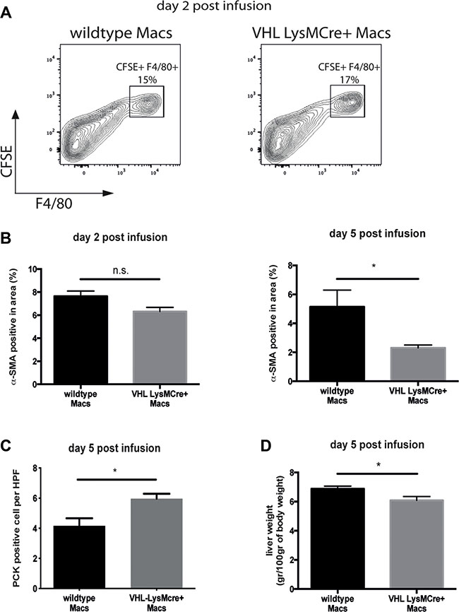 Therapy with VHL-deficient macrophages accelerates fibrosis resolution.