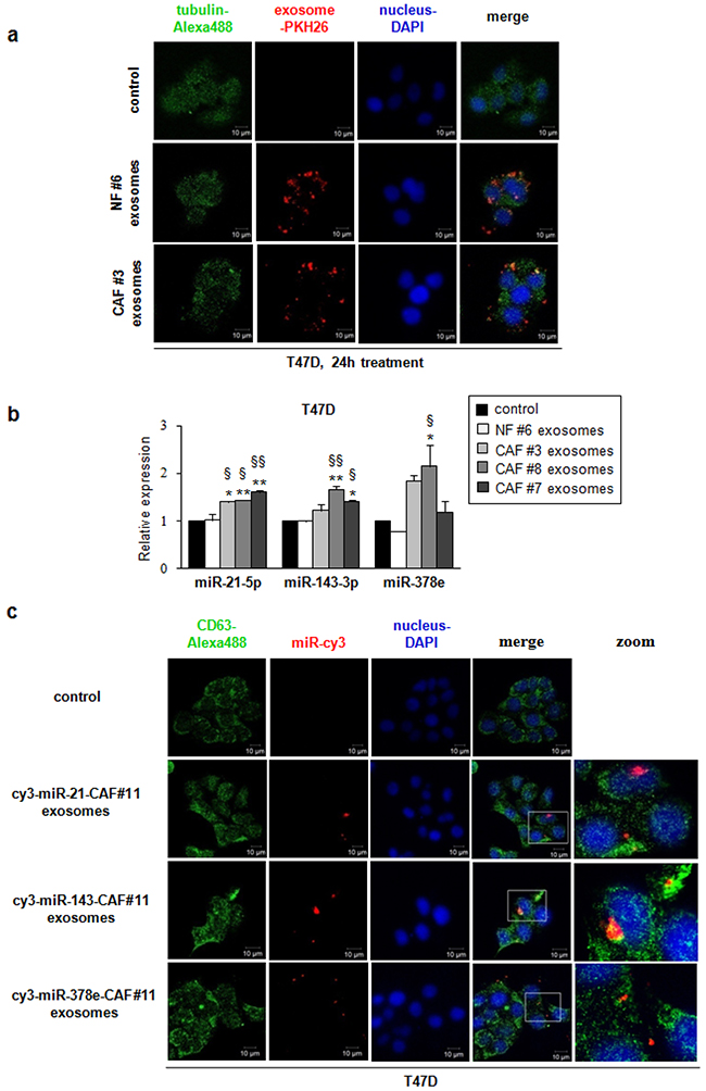 Breast fibroblast-derived exosomes are transferred to T47D cells and miRs -21, -143, and -378e are shuttled by CAF exosomes into breast cancer cells.