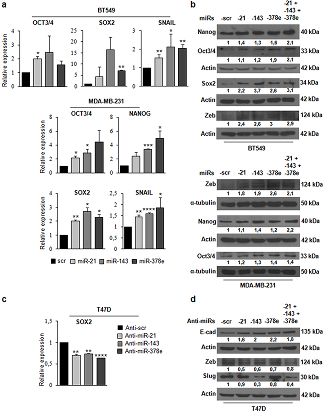 Effects of miRs-21, -143, and -378e on stemness and EMT markers in triple-negative breast cancer cells.