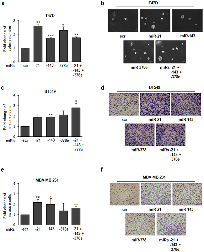 miRs -21, -143, and -378e promote anchorage-independent cell growth and invasive capacity.