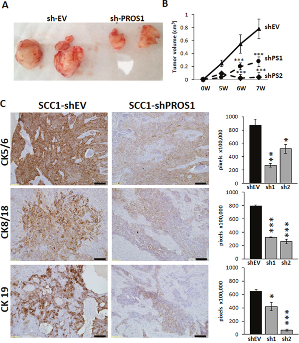 Inhibition of PROS1 in OSCC inhibits tumor growth in a xenograft model.