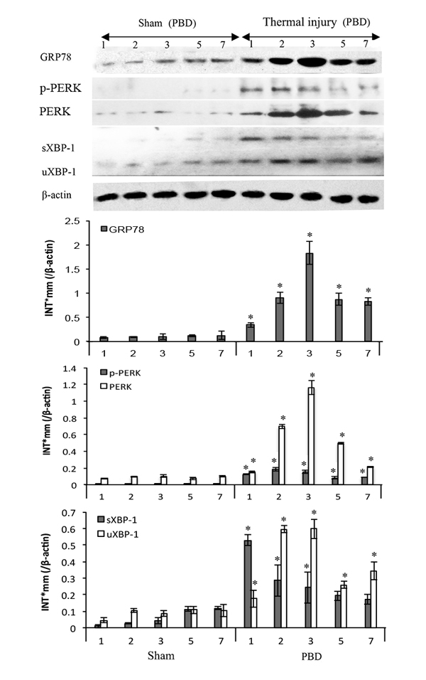 Thermal injury induced ERS response in splenic DC in mice.