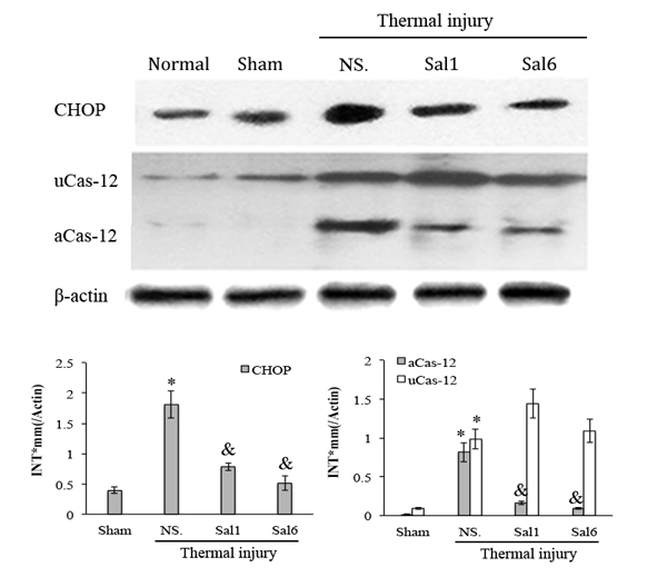 Sal-treatment relieved the ERS response in splenic DCs in thermal injured mice.