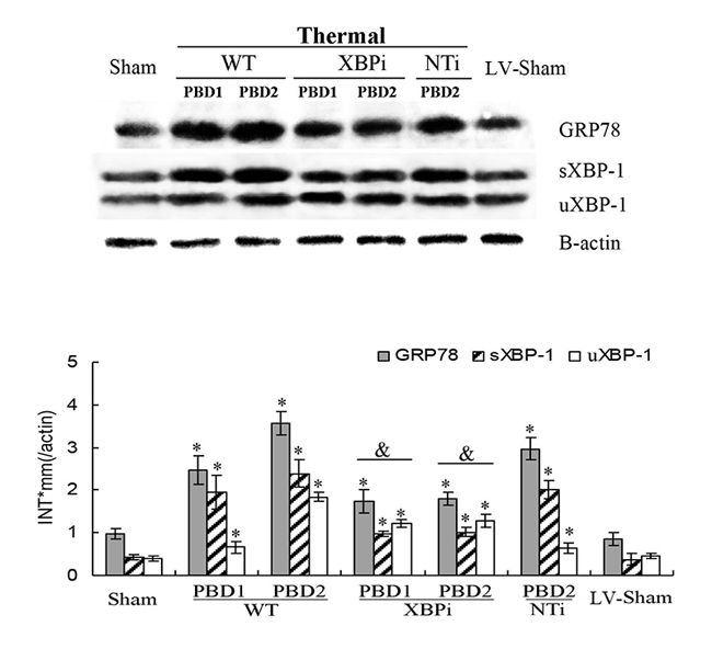 Effects of XBP-1 gene silence in splenic DC in thermal injured mice model.