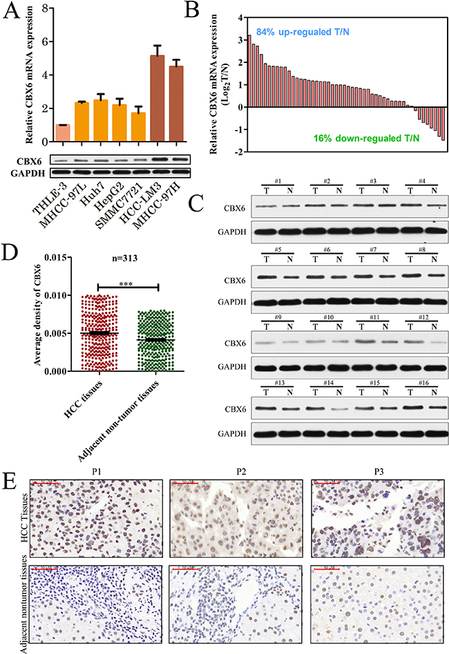 CBX6 expression is frequently increased in human HCC tissues.