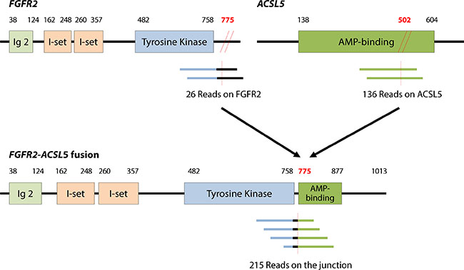 FGFR2-ACSL5 fusion transcript identified by RNA sequencing.
