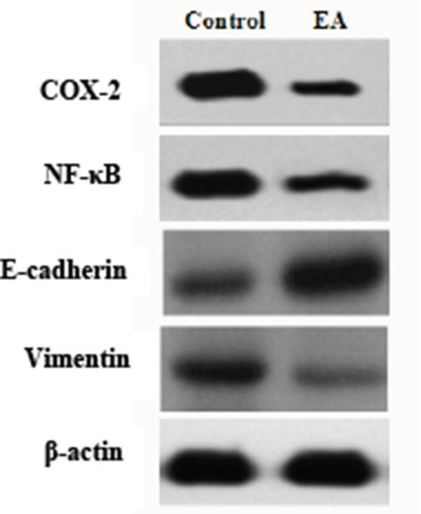 Western blot analysis on the expression of COX-2, NF-&#x03BA;B, E-cadherin and Vimentin.