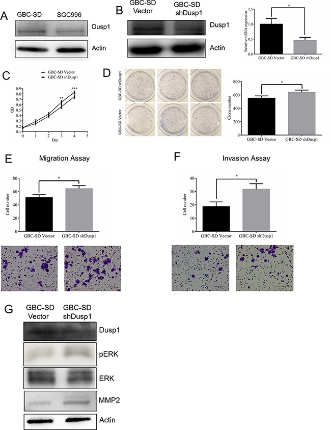 Knocking down DUSP1 in gallbladder cancer cell lines GBC-SD.