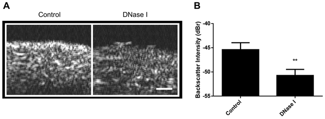 Imaging of DNase I treatment in excised mouse liver.