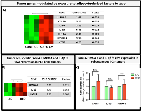 FABP4, IL-1&#x3b2;, and HMOX-1 are expressed in tumor cells exposed to adipocyte-derived factors in vitro and in bone tumors in vivo.