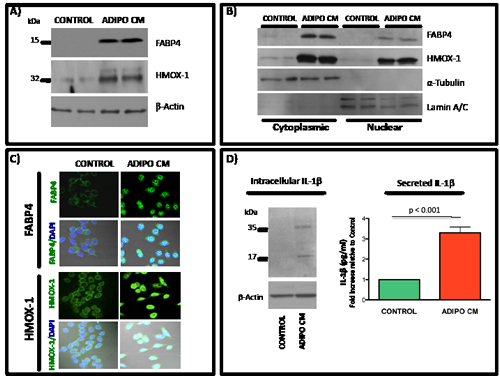 Induced expression of FABP4, HMOX-1 and IL-1&#x3b2; and nuclear translocation of FABP4 and HMOX-1 upon exposure of PC3 cells to Adipo CM.