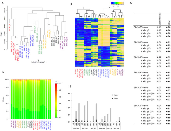 DNA methylation profile in cultured cells and their correlation to the primary tumor.