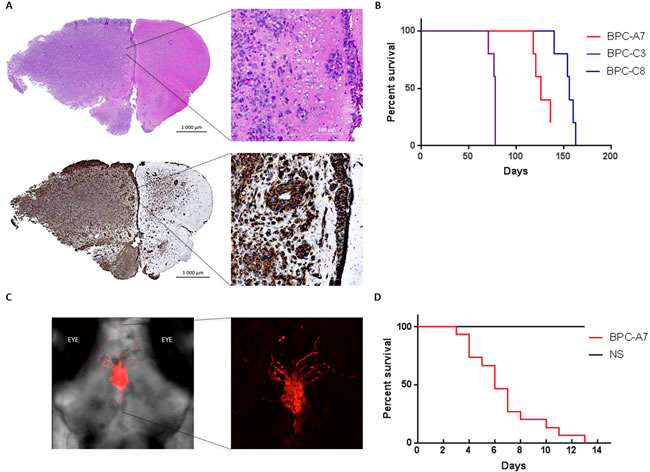 The pediatric tumor cells are tumorigenic when injected into the brains of immunodeficient mice and zebrafish.