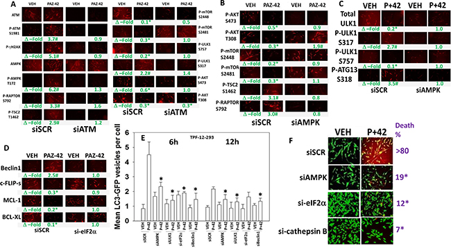 ATM-AMPK signaling and ER stress signaling are required for [pazopanib + AR42] to kill.