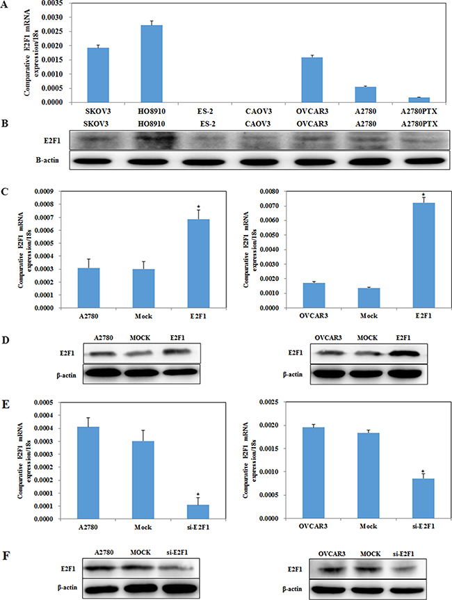 E2F1 expression in ovarian cancer cell lines.