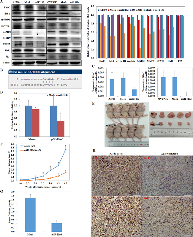MiR-519d inhibits ovarian carcinoma and downregulates RhoC directly.