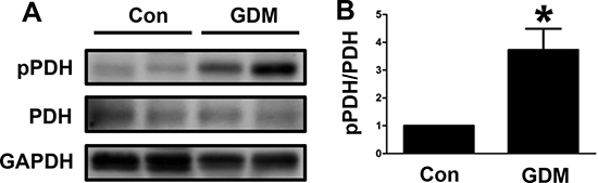 PDH phosphorylation in umbilical cord blood lymphocytes from GDM patients.