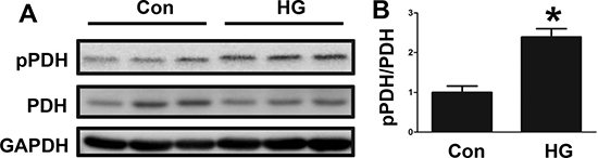 Changes in PDH phosphorylation in high glucose-treated HepG2 cells.