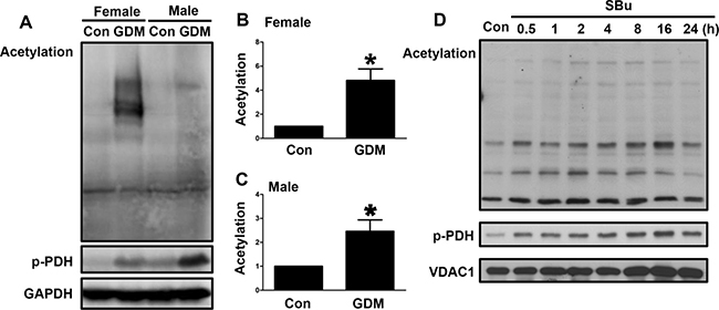 Changes in acetylation in the livers of F1-GDM mice.