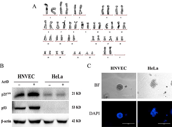 HNVEC cells maintain normal karyotype and response to DNA damage.