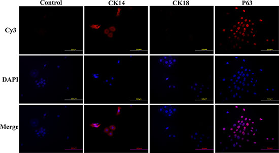 HNVEC cells express CK14, not CK18.