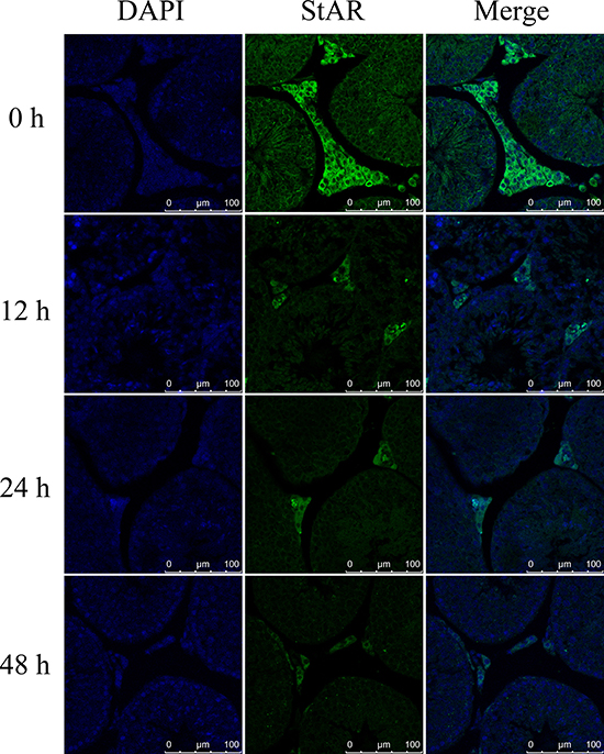The expression of StAR in Leydig cells in vivo after hypoxia treatment.