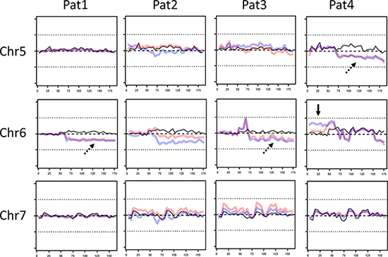 Representative copy number variations (CNV) on chromosomes 5-7 of patient 1-4.