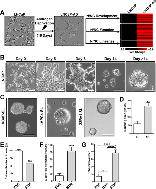 Developmental reprogramming of PCa Cells to a stem-like intermediate.