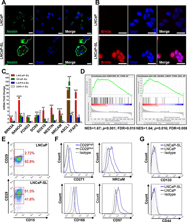 Developmentally reprogrammed PCa cells have characteristics of NC stem cells.