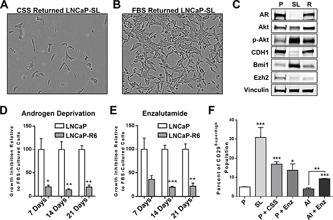 Reprogramming in vitro by androgen-deprivation and acquired therapy resistance.