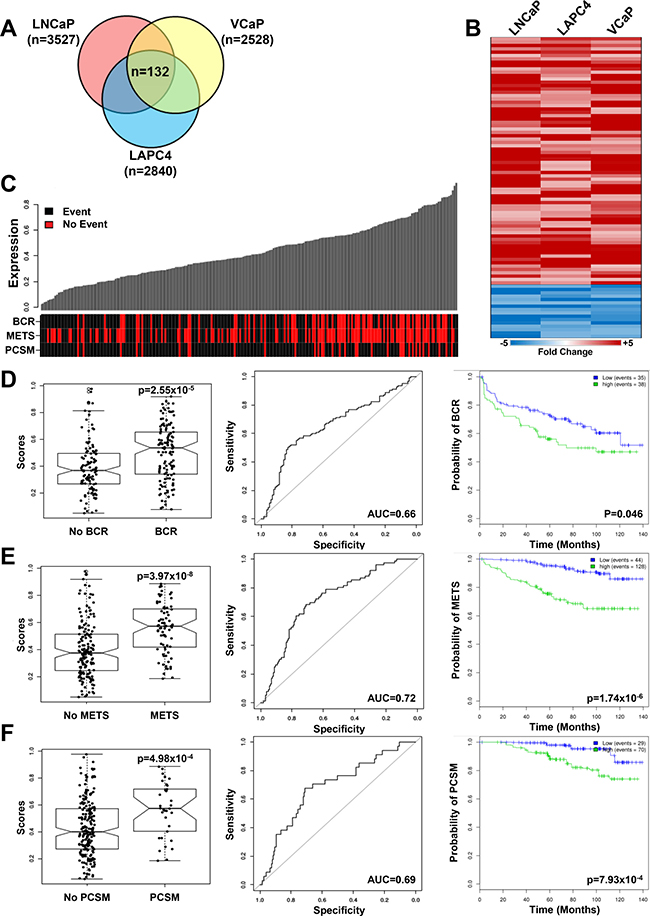 Reprogrammed PCa cells share a gene signature that correlates with adverse outcomes in patients.