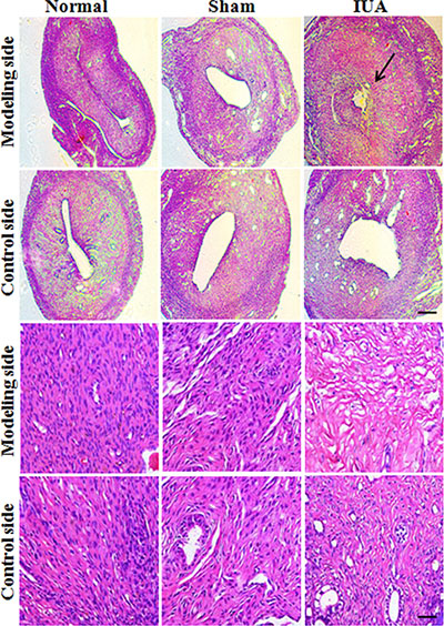 HE staining revealed the abnormal morphology in Asherman syndrome rats.