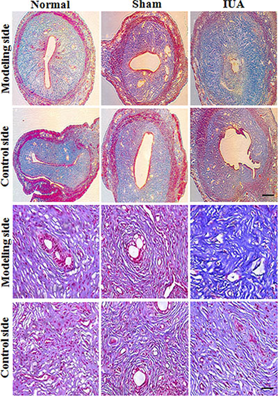 Masson staining revealed the abnormal morphology in Asherman syndrome rats.