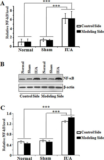 Figure 4 : Determination of NF-&#x03BA;B expression in Asherman syndrome rats.