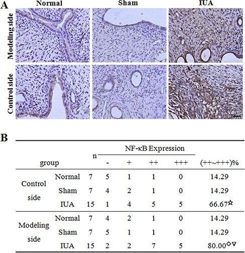 IHC staining of NF-&#x03BA;B in Asherman syndrome rats.