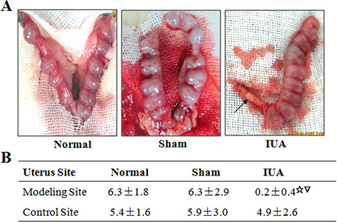 Intrauterine adhesion impaired pregnancy in Asherman syndrome rats.