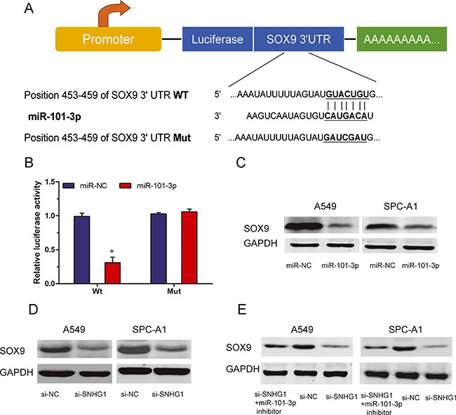 SOX9 is a target of miR-101-3p and is suppressed by SNHG1 inhibition.