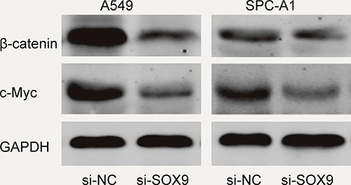 SOX9 activated the Wnt/&#x03B2;-catenin signaling pathway in A549 and SPC-A1 cells.