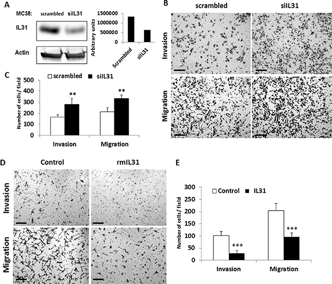 IL31 inhibits tumor cell invasion and migration.