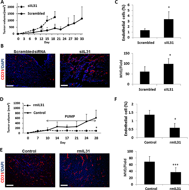 IL31 inhibits tumor growth and angiogenesis.