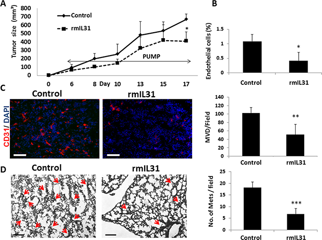 IL31 inhibits angiogenesis and lung metastasis in 4T1 metastatic breast carcinoma.